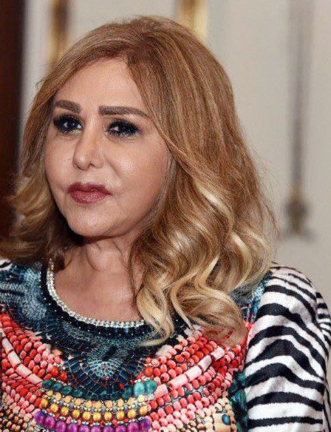 Maha Al-Masri distorted face failed plastic surgery unsuccessful filler shocking