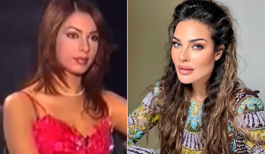 "nadine njeim before and after"