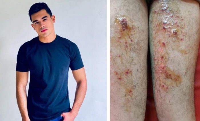 يوسف عمرو إصابة Youssef Amr injury