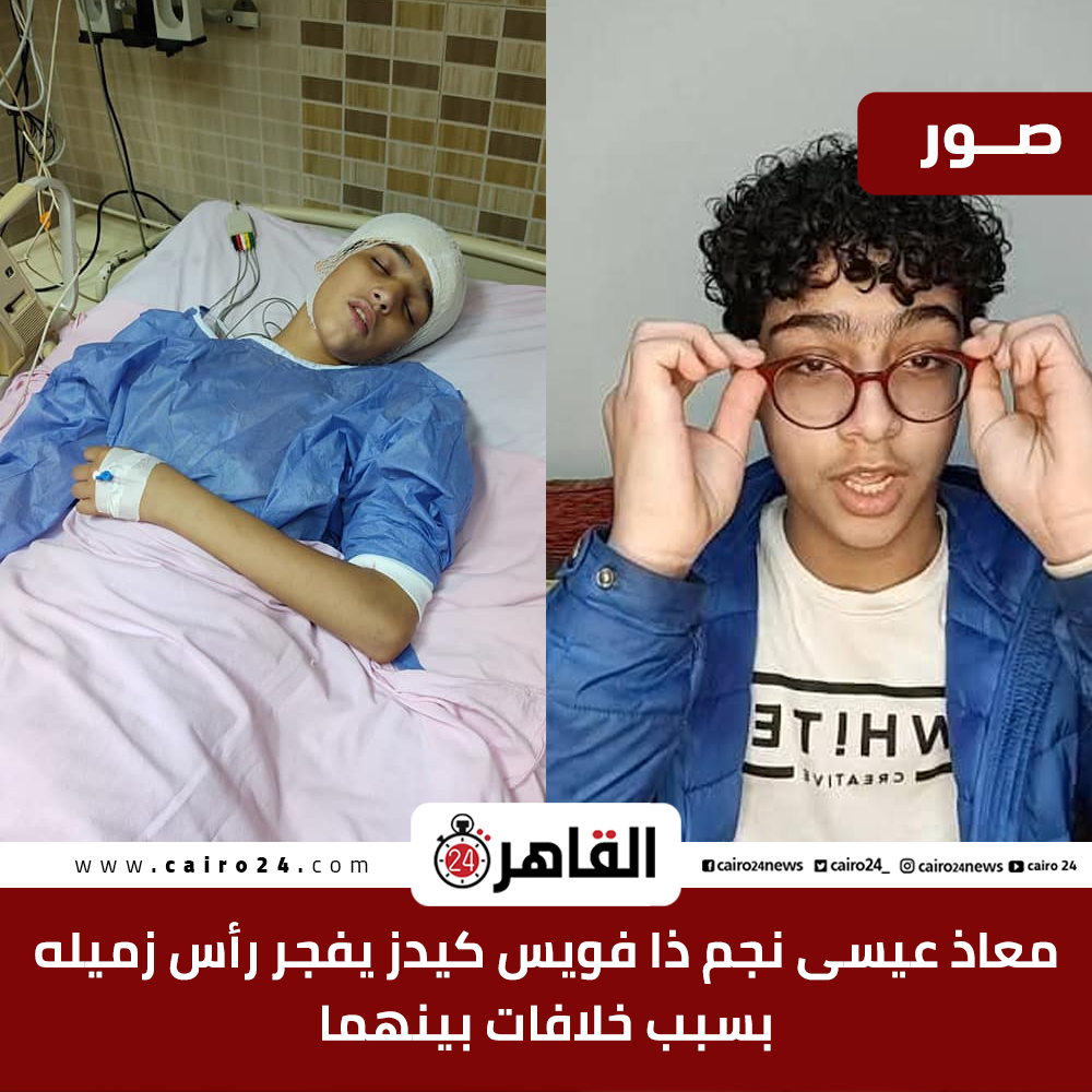 The Voice Kids Contestant Moaz Issa Attempted Murder Egypt