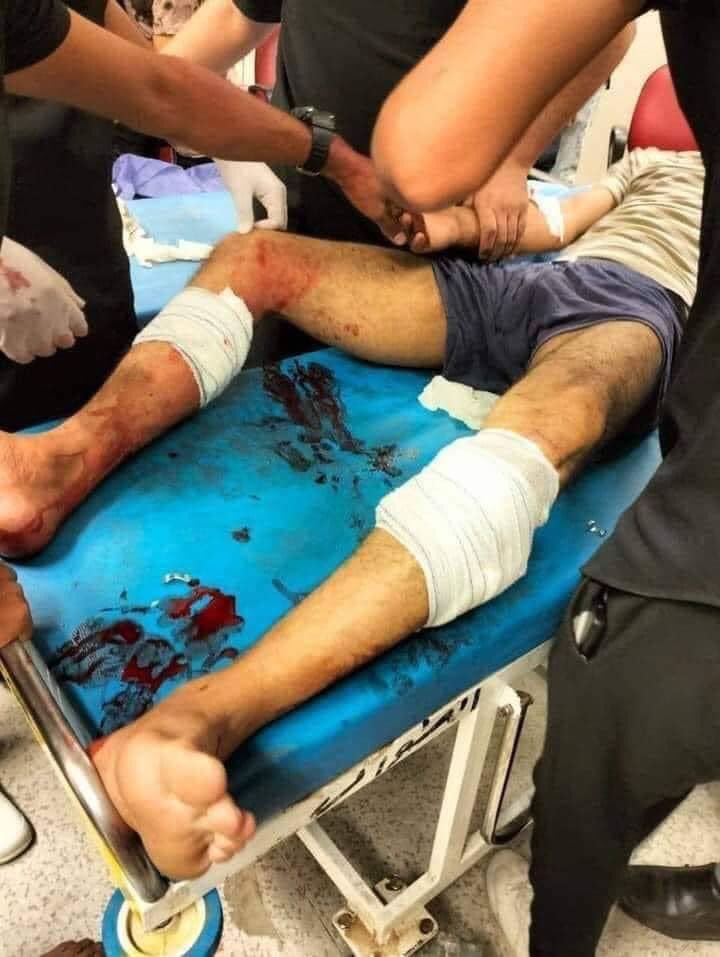 ""صورة تظهر الناشط العراقي إحسان أبو كوثر في المستشفى مصابا بكلتا ساقيه