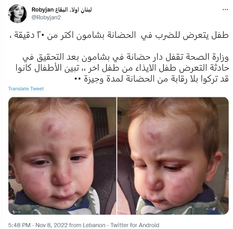 "ضرب رضيع داخل حضانة في لبنان"
