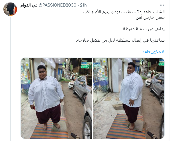 علاج حامد