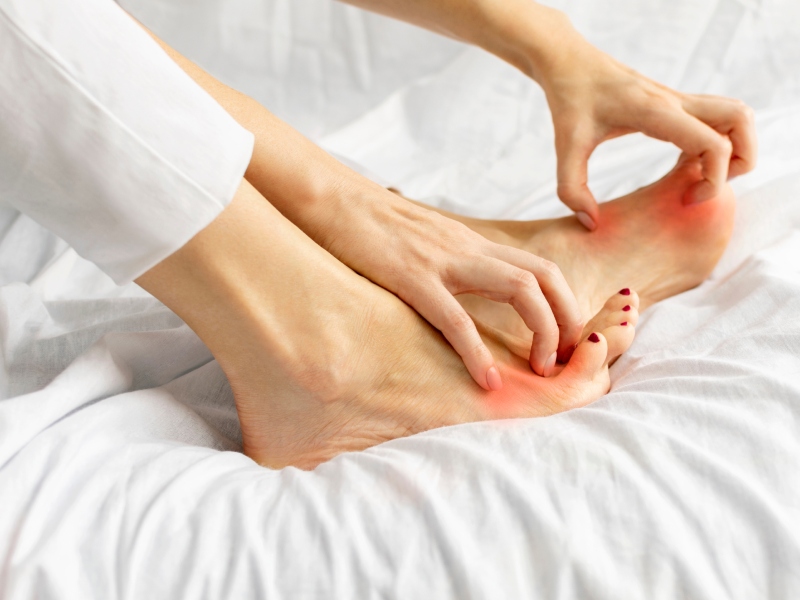 طبيب البوابة: أعراض الغدة الدرقية في الأقدام