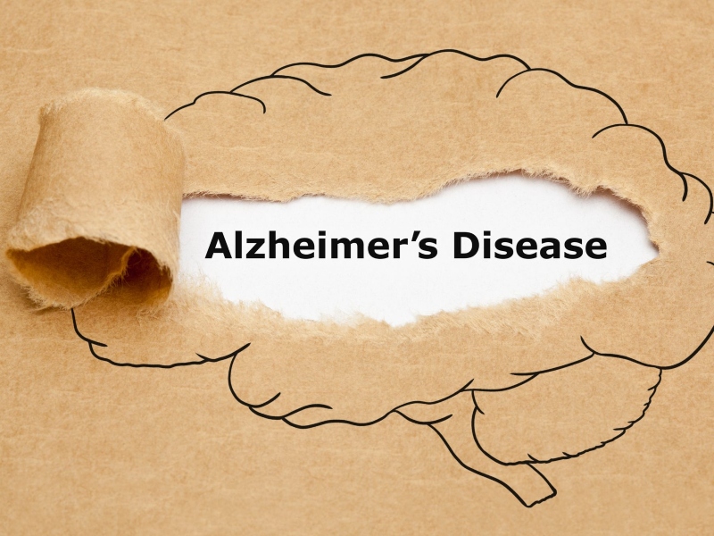 طبيب البوابة: ما الفرق بين الخرف والزهايمر؟