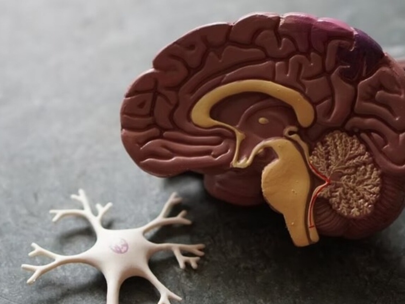 طبيب البوابة: ما الفرق بين الخرف والزهايمر؟