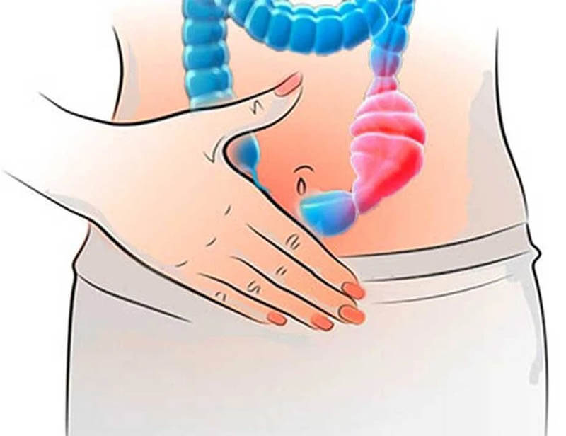 علاج الإمساك