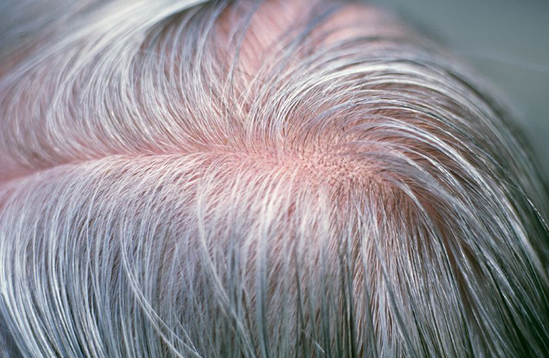 فوائد حمض الفوليك للشعر الأبيض