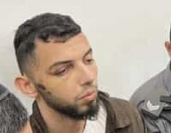  الشاب صبيحات تعرض للكمة أسفل عينه