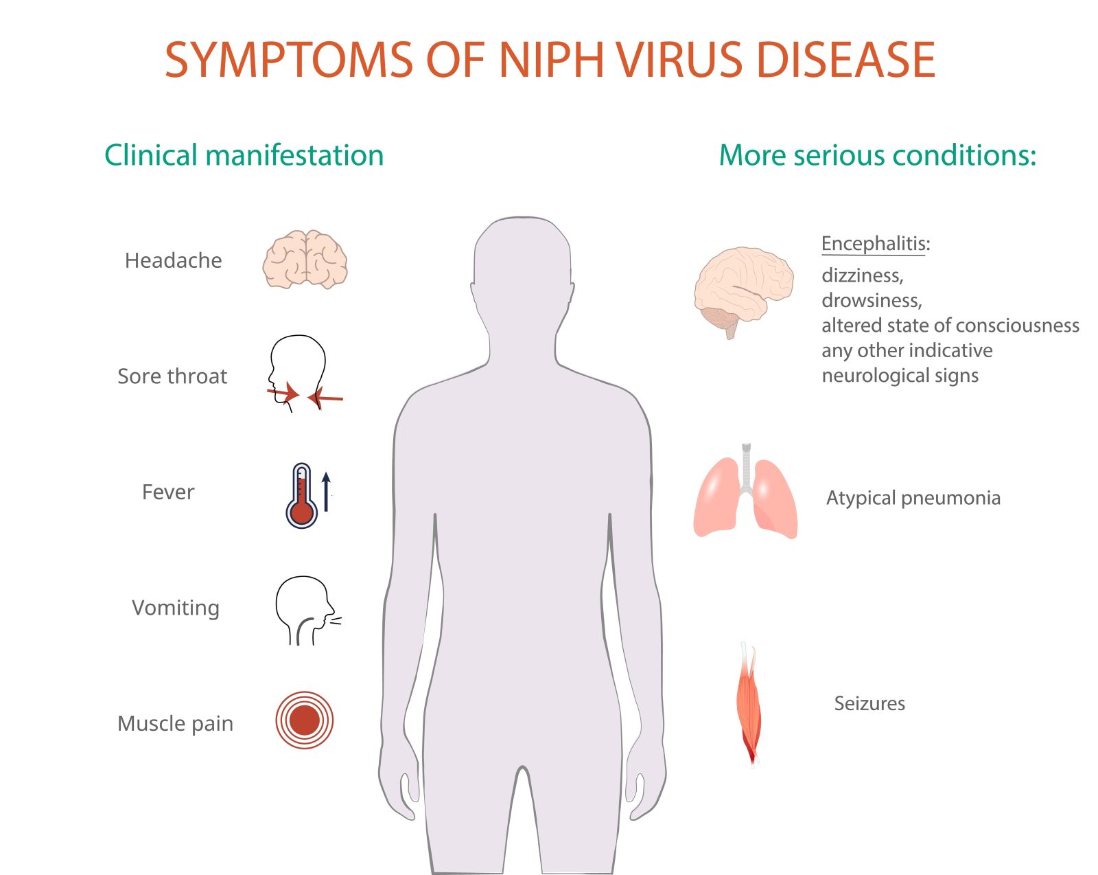 Nipah virus