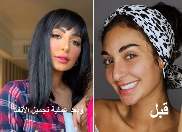 نور الغندور قبل وبعد التجميل