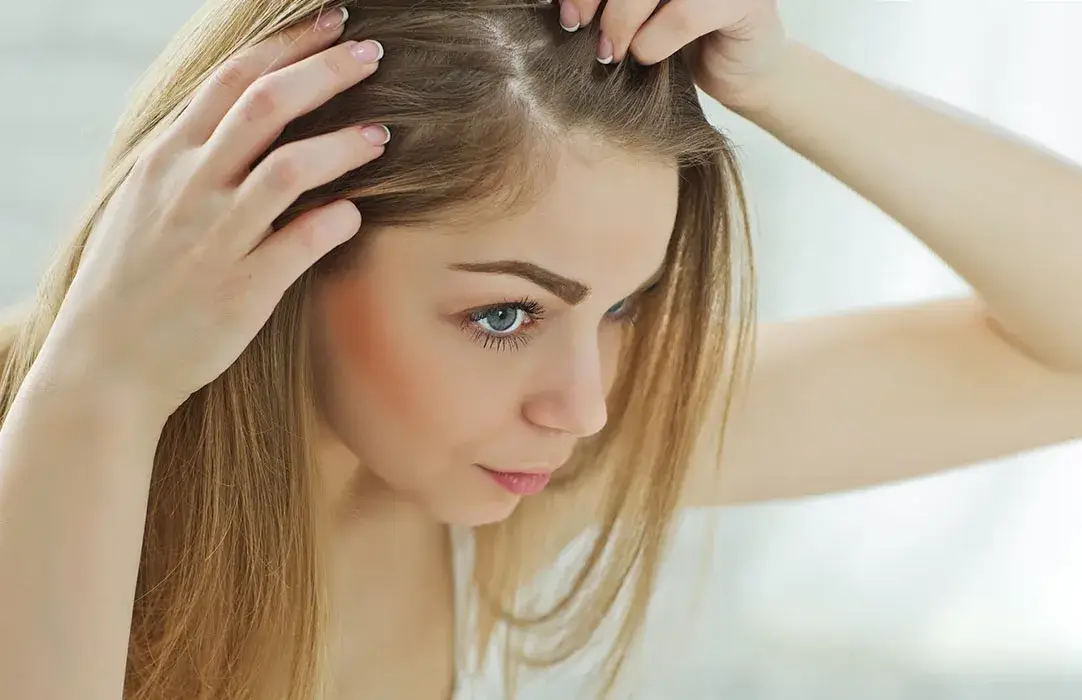 تفسير حلم نزع القمل من الشعر وقتله للمتزوجة لابن سيرين