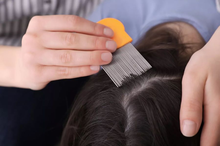 تفسير حلم نزع القمل من الشعر وقتله للمتزوجة