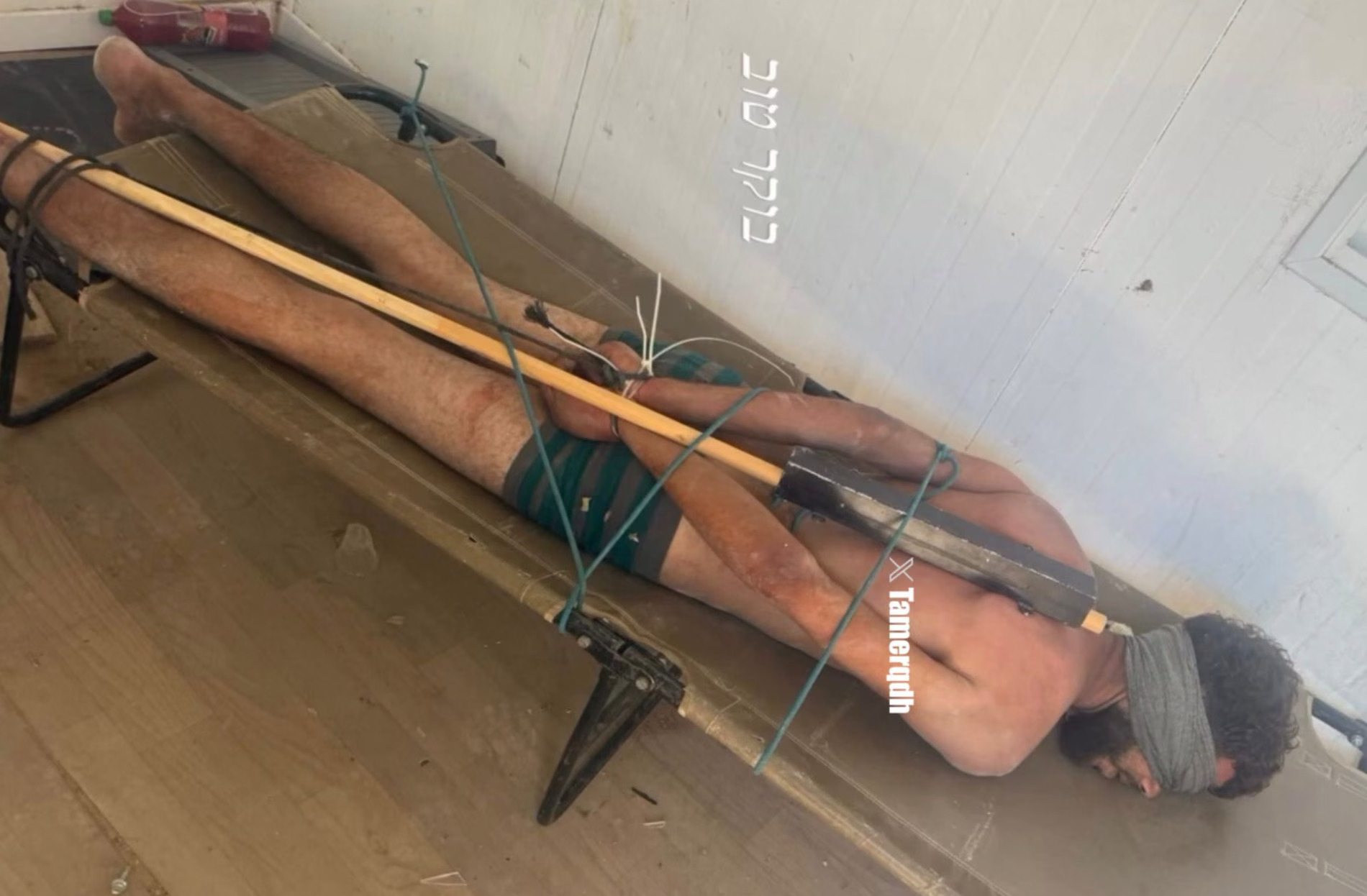 Tortured Palestinian Prisoner