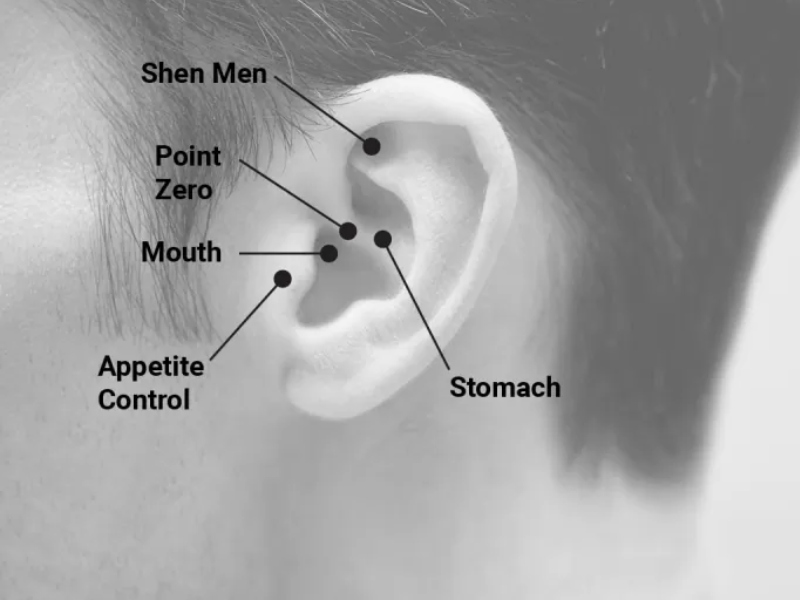 طبيب البوابة: العلاج بالمغناطيس لتخفيف الوزن