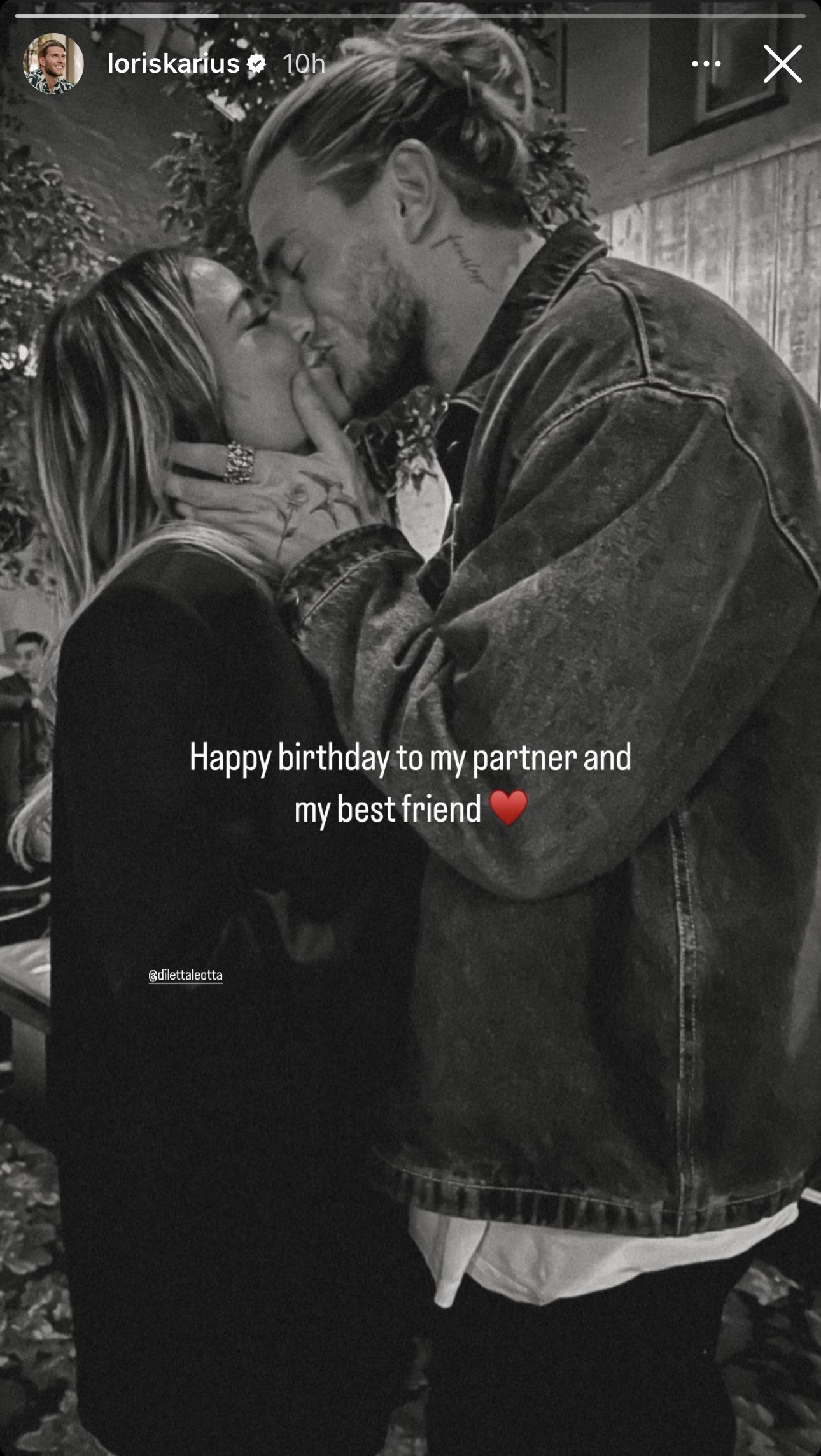 Loris Karius kissing diletta leotta.. is can yaman jealous 