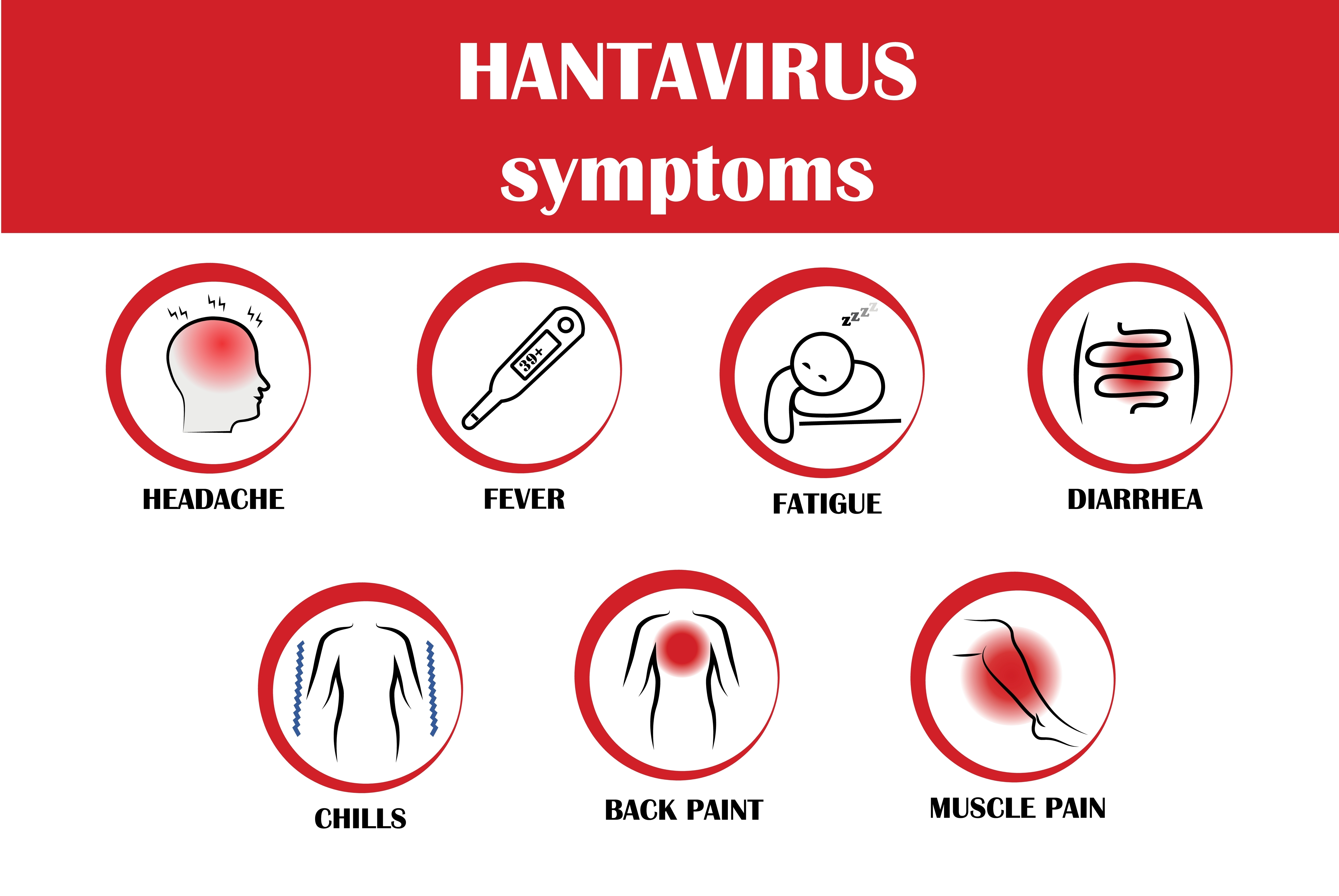 Hantavirus
