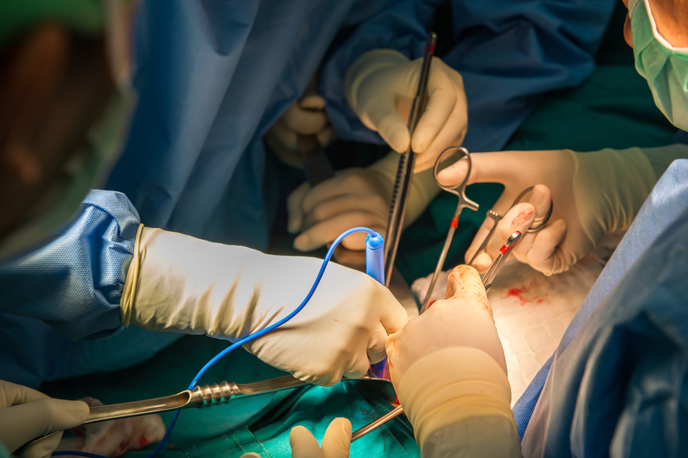 Iraqi man lures son and sells his kidney