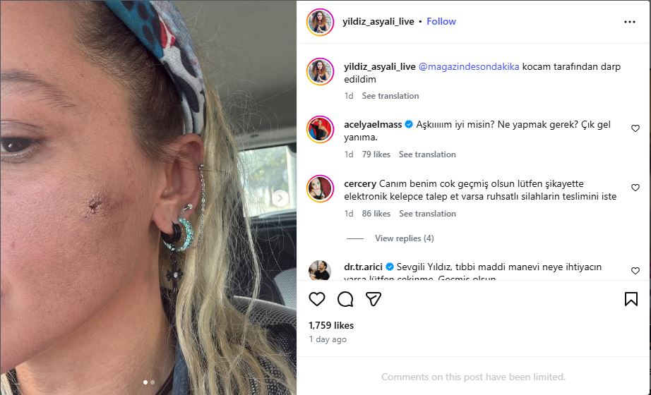 Turkish artist Yildiz Asyalı