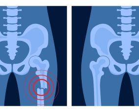 bone glue