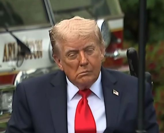 "Trump Is Dying:" White house dismisses photos as minor vein problems