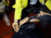 This picture taken on January 14, 2020 shows details of injury scars as part of 1:6 scale action figures depicting characters involved in the Hong Kong protests, in Hong Kong. Intricately detailed Hong Kong protester figurines have become the latest must-have collectables as toy stores recreate the pro-democracy movement's street battles with police in their shop displays.  Philip FONG / AFP