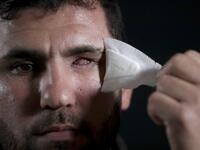 Sami Marsan, who lost his left eye in the ongoing conflict with Israel, poses during a photo session in Bureij refugee camp in central Gaza, on February 4 , 2020. Along the border of the Gaza Strip, the Israeli army uses snipers who, according to instructions, open fire only when the soldiers are at risk from intensifying violence from Palestinian rioters. Some were taking part in clashes, others simply in the wrong place at the wrong time. All were left scarred and their lives wrecked, even though in Pales