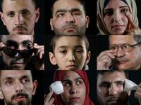 This combination of pictures created on June 11, 2020 shows (Top L to R) Mohammed Burqan, who lost his left eye, posing during a photo session in Jerusalem; Muath Amarneh, who lost his left eye, posing during a photo session in Ramallah; Jacqueline Shahada, who lost her left eye, posing during a photo session in Bureij refugee camp in central Gaza; (Middle L to R) Ahmed al-Louth, who lost his left eye, posing during a photo session in Bureij refugee camp in central Gaza; Malek Issa, 9, who lost his left eye