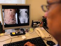Lebanese doctor Selim Nasser displays the image of a patient's body. ANWAR AMRO / AFP