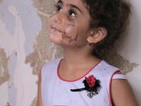 Yara, a 3-year-old girl, who was injured in the massive Beirut port explosion. Twitter