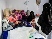 Al-Anoud Hussain Sheryan (L), a 19-year-old girl disfigured in an acid attack by her abusive husband, sits at a hospital where she is undergoing treatment in Yemen's capital Sanaa on January 28, 2021. Married at the age of 12, rejected at 16, and then disfigured in an acid attack, Sheryan's fate is a shocking illustration of abuse in a society beset by war and poverty. Now aged 19, the young Yemeni woman agreed to relate her ordeal at the hands of her abusive husband -- rare testimony in a country where dom