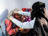 Al-Anoud Hussain Sheryan, a 19-year-old girl disfigured in an acid attack by her abusive husband, sits at a hospital where she is undergoing treatment in Yemen's capital Sanaa on January 28, 2021 as a woman unwraps her veil to show her injuries. Married at the age of 12, rejected at 16, and then disfigured in an acid attack, Sheryan's fate is a shocking illustration of abuse in a society beset by war and poverty. Now aged 19, the young Yemeni woman agreed to relate her ordeal at the hands of her abusive hus