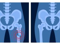 bone glue