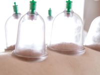 الحجامة... هي الكنز الخفي لمرضى القلب