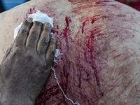 A medical volunteer cleans the blood on the back of a Kashmiri Shiite Muslim mourner who flagellates himself during a religious procession held on the seventh day of Ashura which remembers the slaying of the Prophet Muhammed's grandson in southern Iraq in the seventh century, in Srinagar on September 18, 2018.TAUSEEF MUSTAFA / AFP