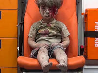 Damned if you stay, damned if you go: A young Syrian boy sits injured in the back of an ambulance after being pulled from the rubble by civil defense workers following a reported government airstrike in eastern Aleppo.