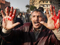 An anti-government protestor shows blooded hands from an injury received during clashes with supporters of President Mubarak in Tahrir Square.