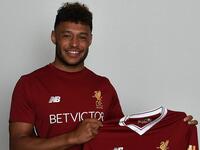 لاعب الوسط الإنجليزي أليكس أوكسلايد تشايمبرلين: من آرسنال إلى ليفربول مقابل 38 مليون يورو.