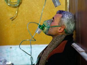 File photo from aftermath of suspected chemical attack in Douma in April. (AFP/ File Photo)