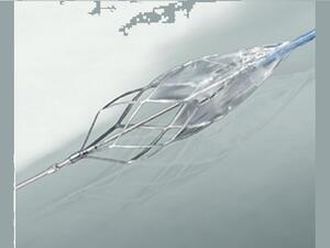 Stent Machine used for the carotid vein to avoid it from collapsing