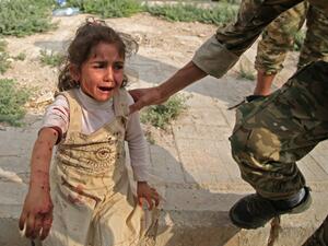 A Syrian girl reacts to her wounds (AFP)
