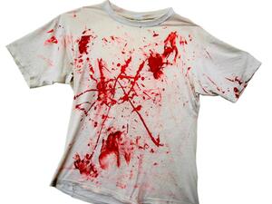 تسهل إزالة بقع الدم فور حدوثها تسهل إزالة بقع الدم فور حدوثها