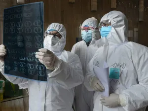 This photo taken on February 20, 2020 shows doctors looking at a lung CT image at a hospital in Yunmeng county, Xiaogan city, in China's central Hubei province. AFP/File