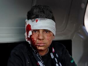 A wonded Syrian child sits inside a vehicle as he is evacuated from the scene of a pro-regime forces air strike in the town Maarrat Misrin in Syria’s northwestern Idlib province, on February 25, 2020. Abdulaziz KETAZ / AFP