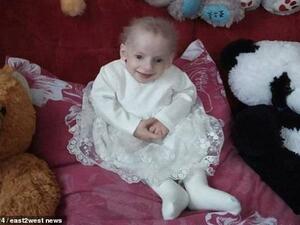 Eight-year-old Anna Sakidon (pictured aged six) died of old age in Ukraine after suffering from an exceptionally rare genetic progeria disease which only affects 160 people in the entire world. (Daily Mail)