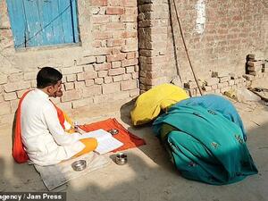 Dabul Mishra, 32, from Shahjehanpur in the state of Uttar Pradesh, was born with a condition that caused his face and lips to grow to outsized proportions. (Daily Mai)