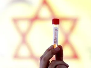 An Israeli medical personnel displays a sample taken from a driver at the Israeli Magen David Adom (MDA) national emergency service drive through complex for COVID-19 testing in Hayarkon Park's Rokach blvd parking lot in the coastal city of Tel Aviv on March 20, 2020. AFP