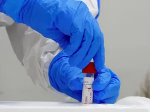 sreal will use security measures in its fight against the virus. (File/AFP)