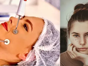 العلاج بالنبضات الكهربائية