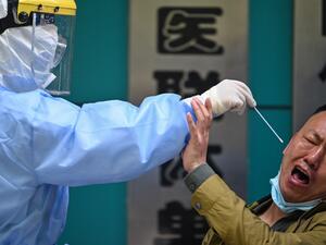 A man being tested for the COVID-19 novel coronavirus reacts as a medical worker takes a swab sample in Wuhan in China's central Hubei province on April 16, 2020. China has largely brought the coronavirus under control within its borders since the outbreak first emerged in the city of Wuhan late last year. Hector RETAMAL / AFP